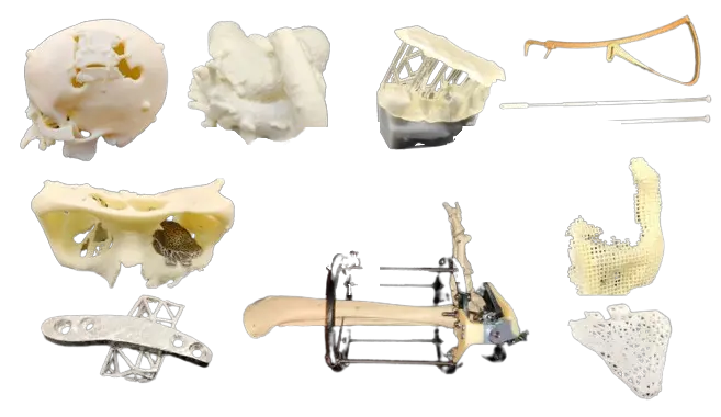Additive manufacturing in medical industry (from NIH)